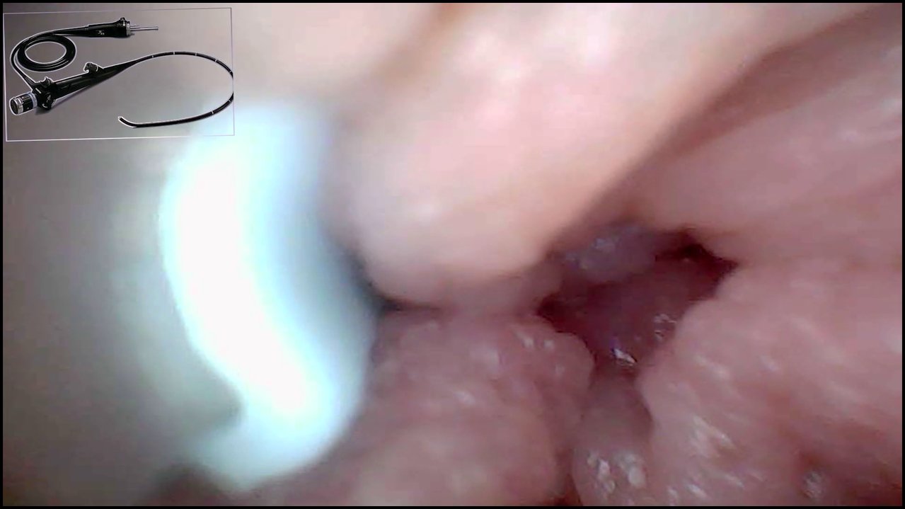 Ladybottox – Exklusiv – Kamera Geht Rein – Wir Haben Meinen G-punkt Gefunden Und 5 Orgasmen Eingefangen